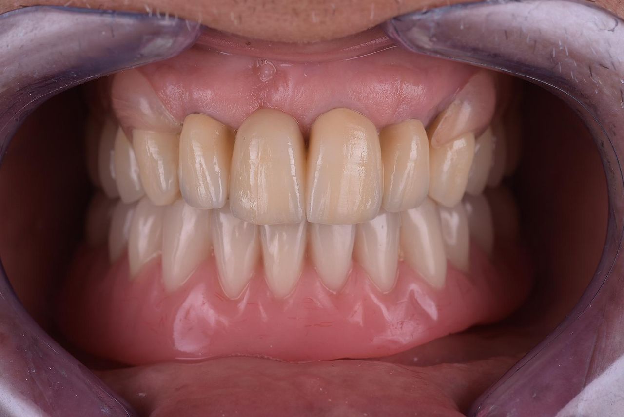 Riccardo Giardina-54