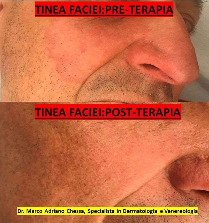 Marco Adriano Chessa-4