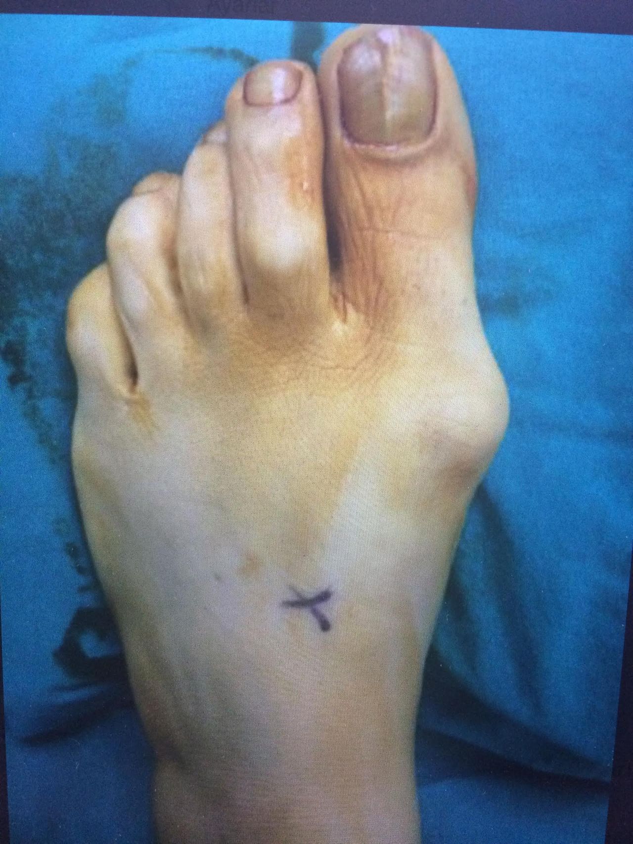 Mehmet Hakan Yılmaz-5