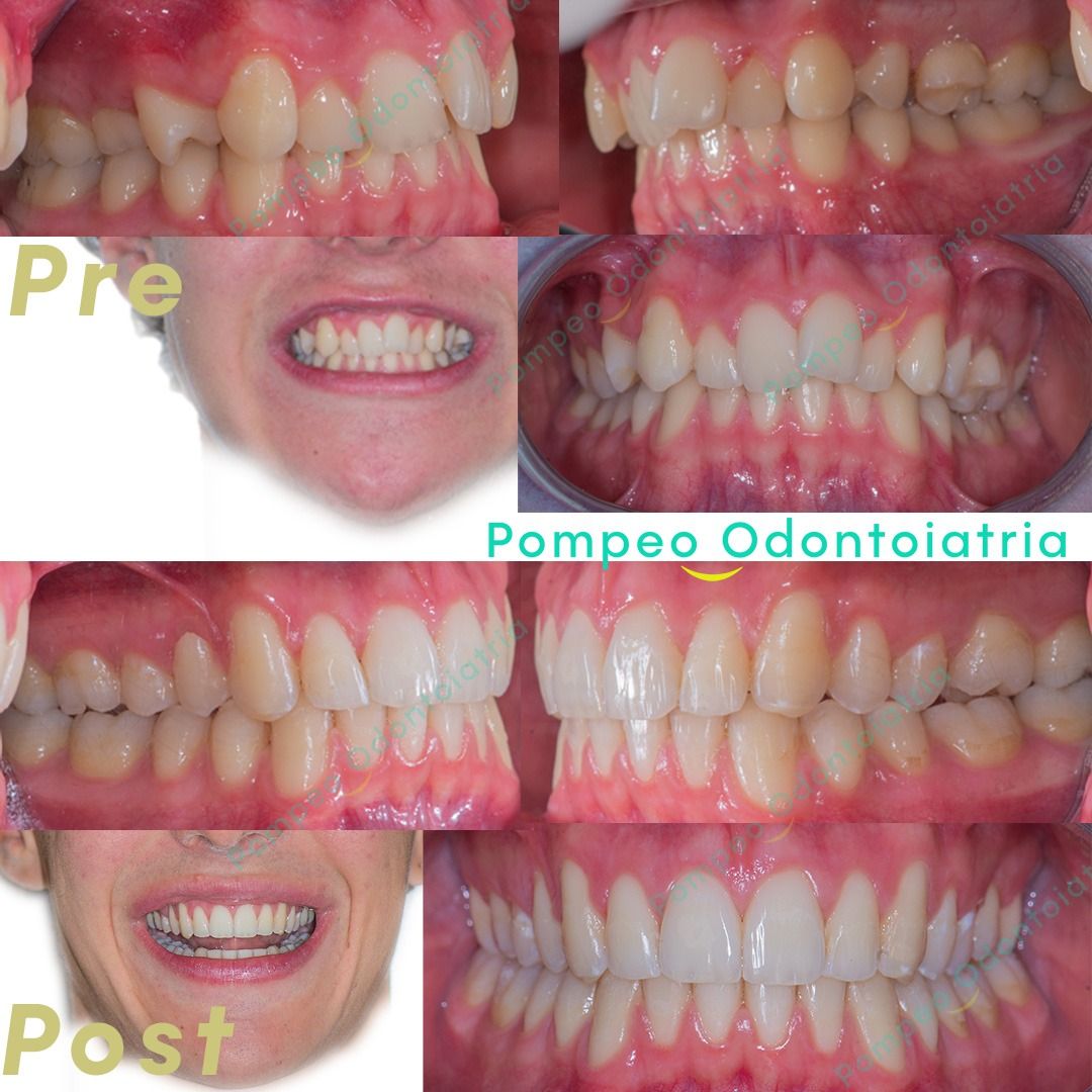Enrico Maria Pompeo-0