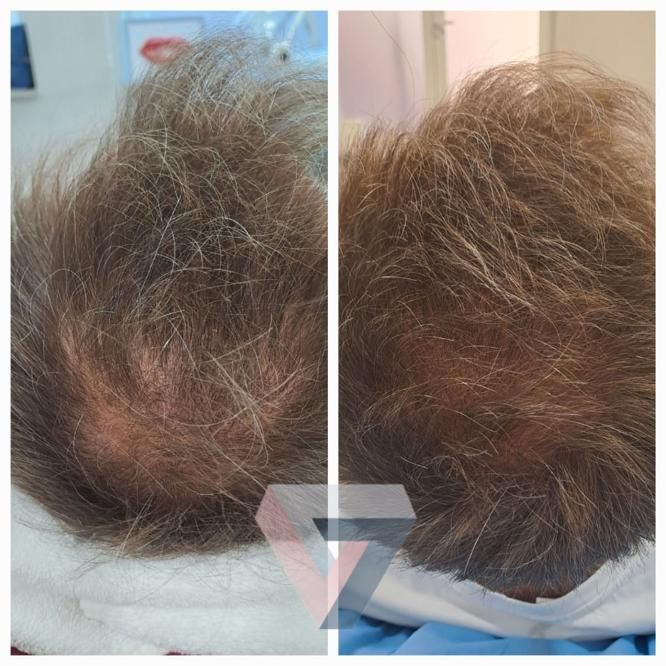 Victoria Trasmonte-80