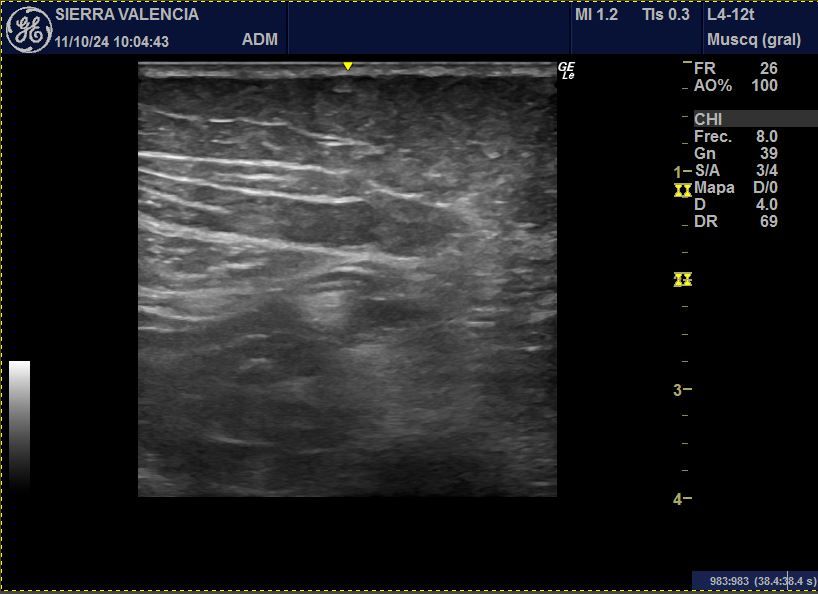 Pablo Llorente Dañino-0