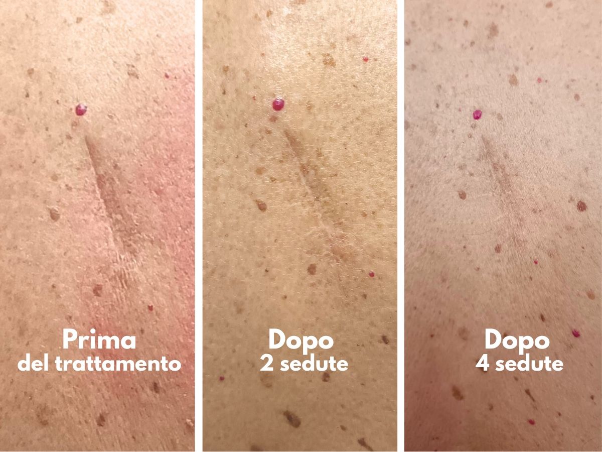 Gianluca Montaruli-2