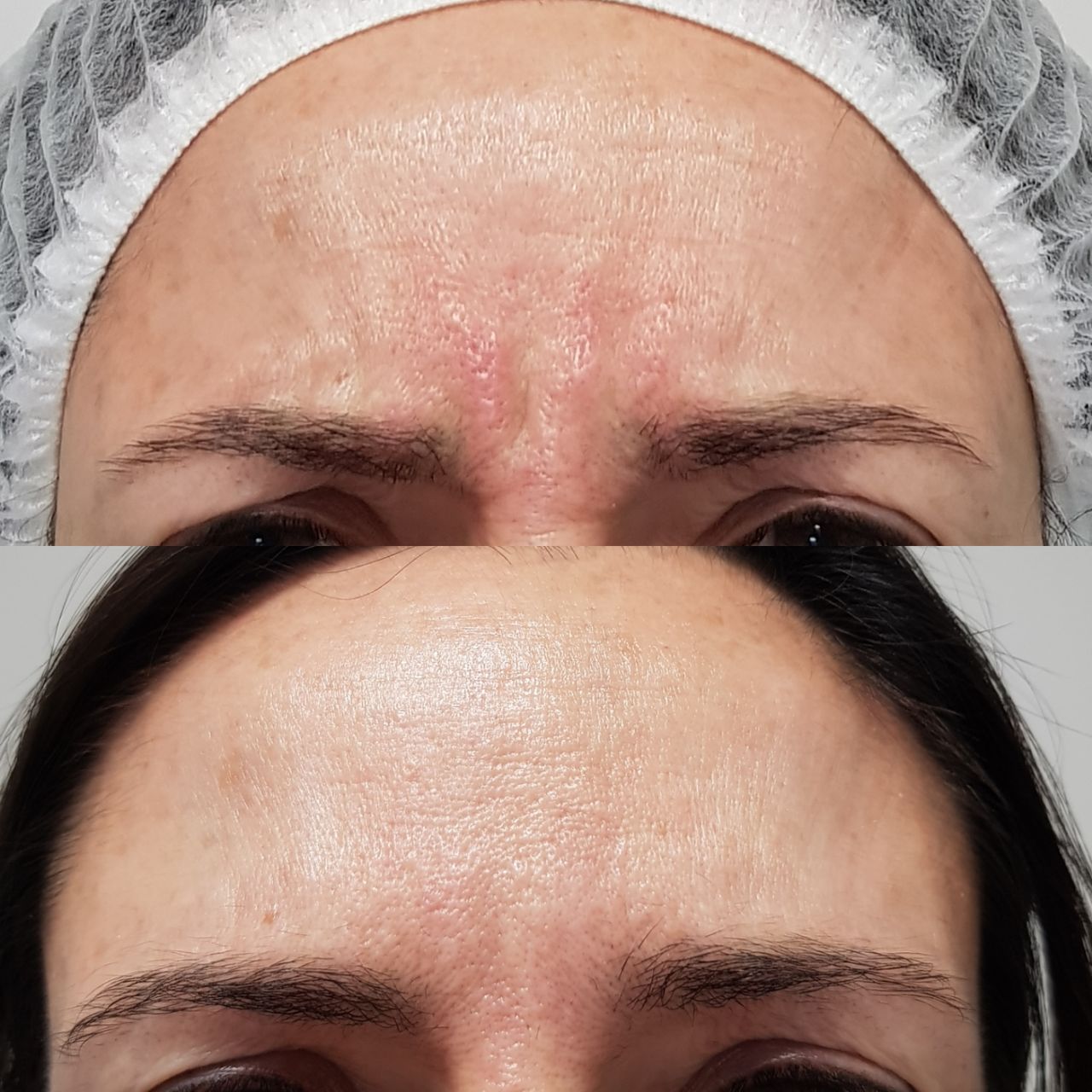 Rosalba Herrero Zerpa-513