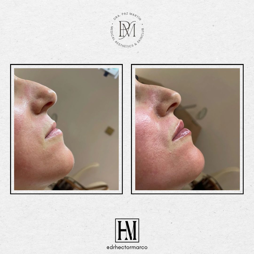 Héctor Marco Ruiz-15