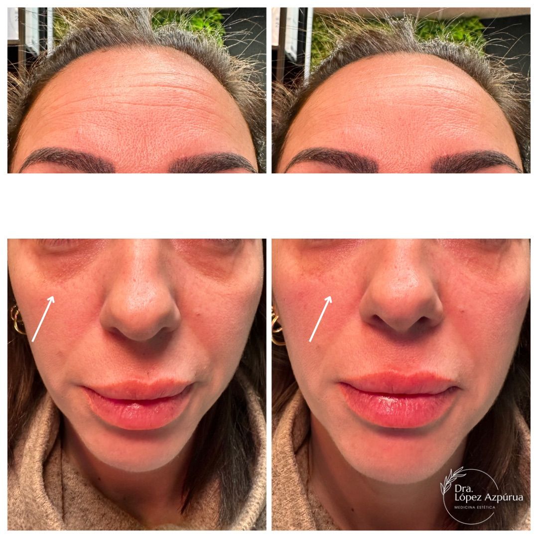 Alexandra López Azpúrua-6