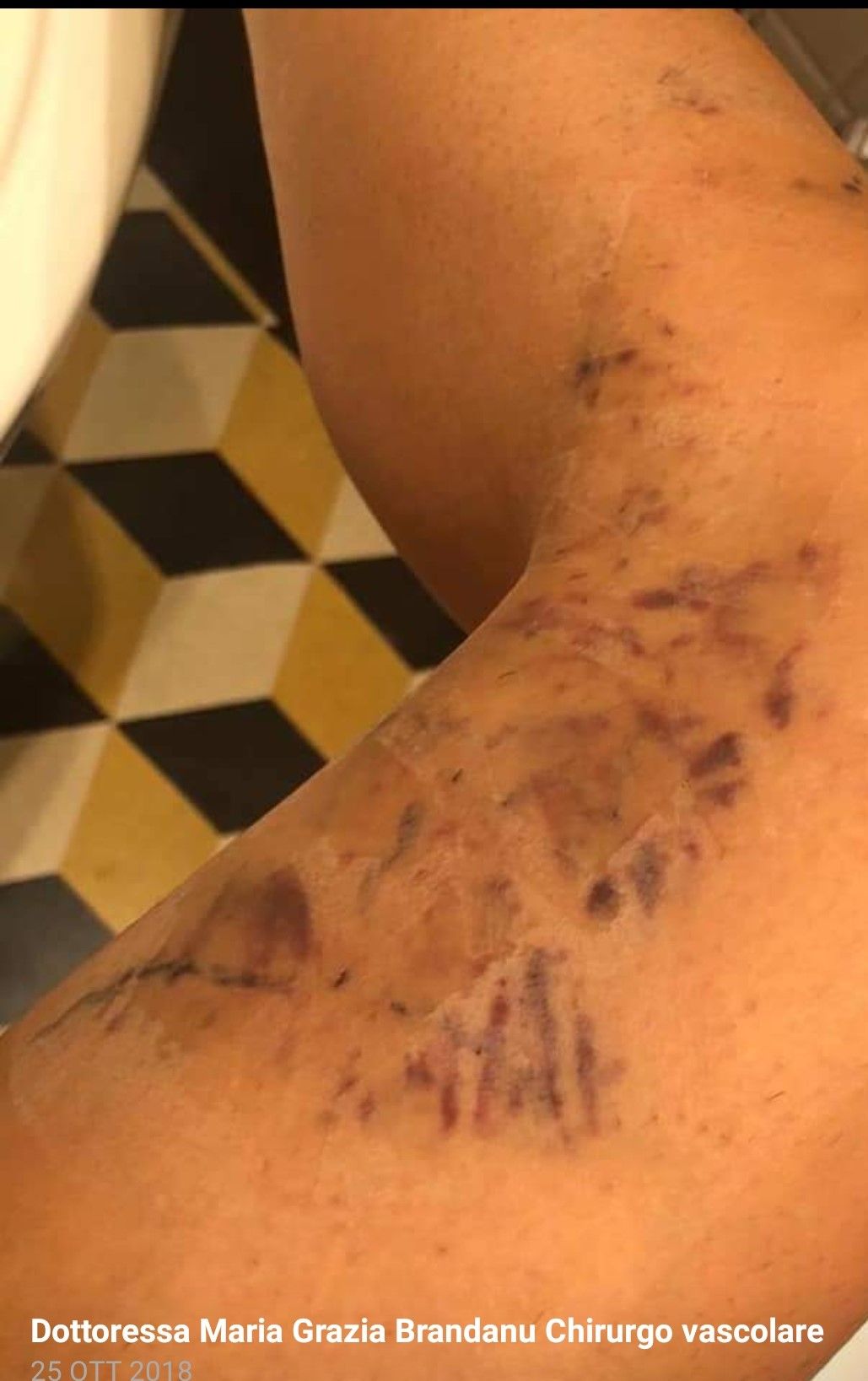 Maria Grazia Brandanu-3