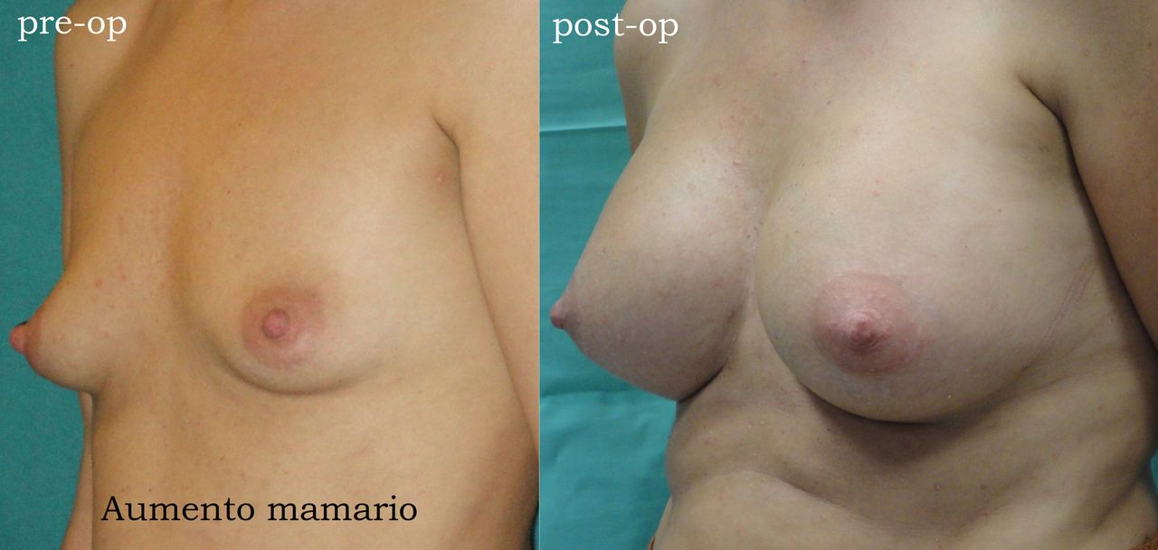 Enrique Bonanad Fernandez-4