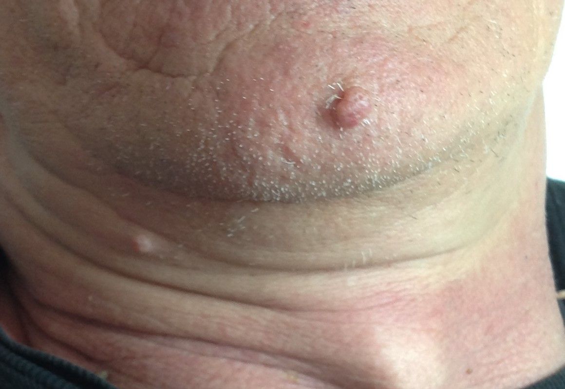 Rosario Antonio Labianca-7