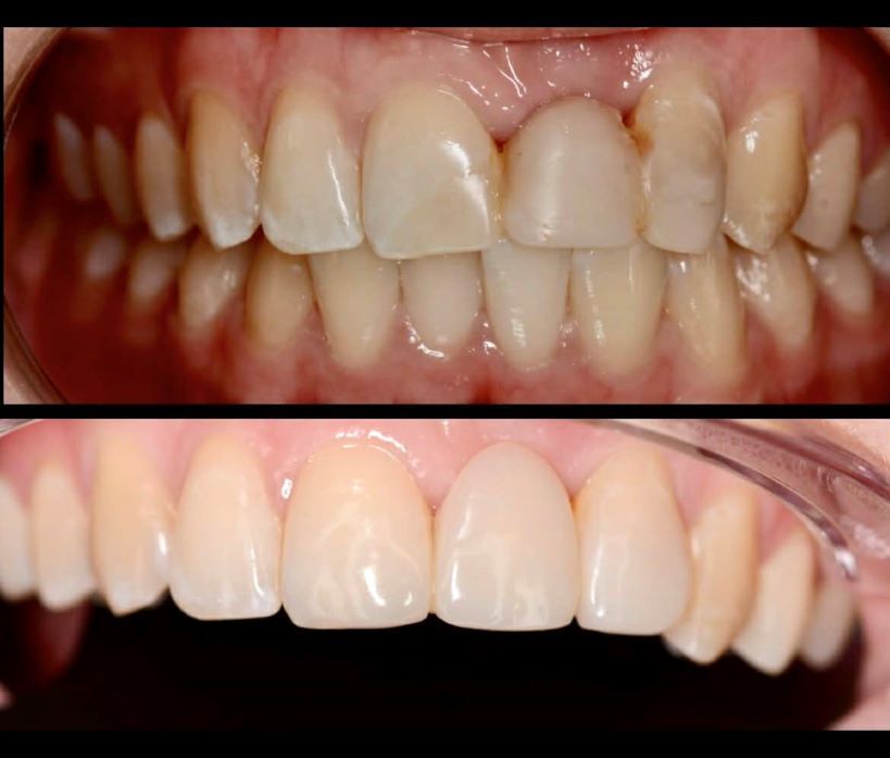 Magdalena Bińkowska-39