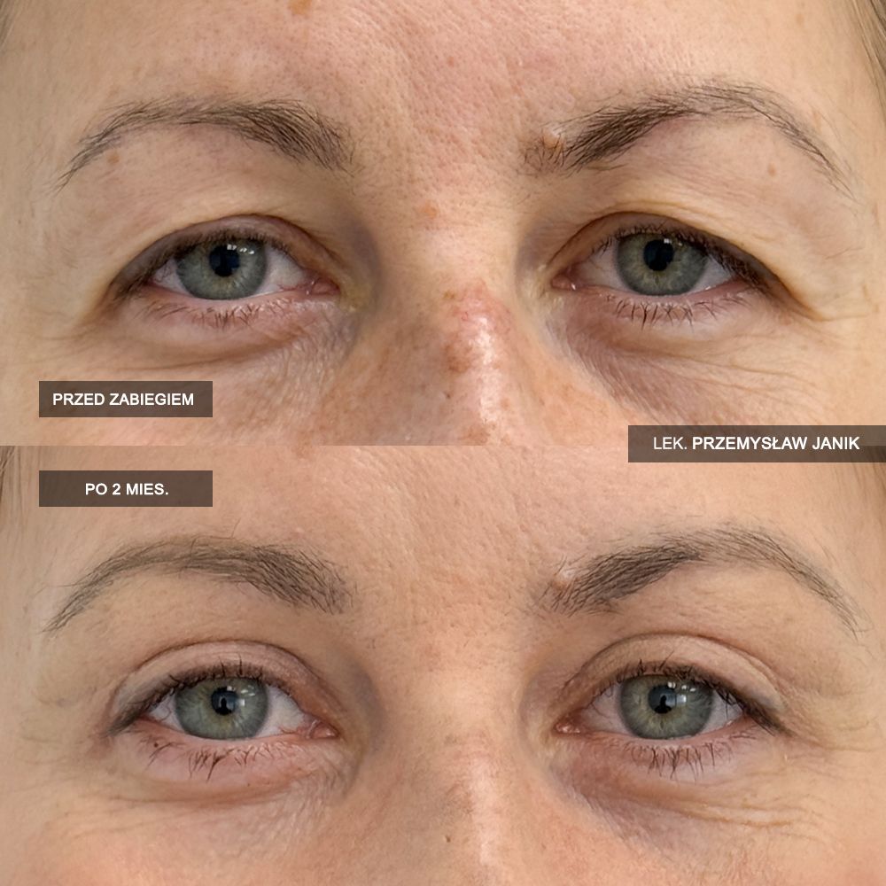 Przemysław Janik-68