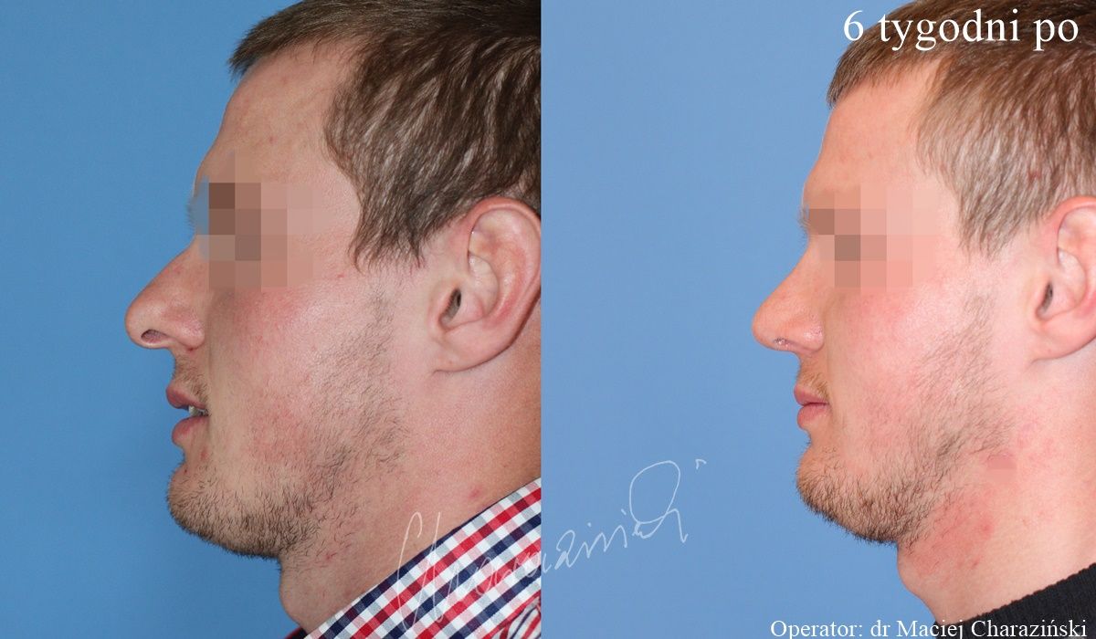 Maciej Charaziński-47