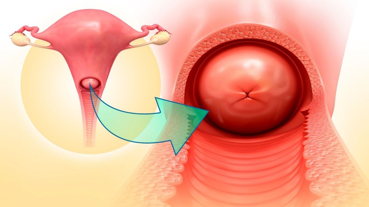 Vincenzo Massimo Prestia-44