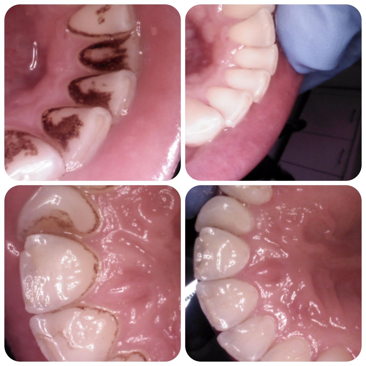 Katarzyna  Kmieć -11