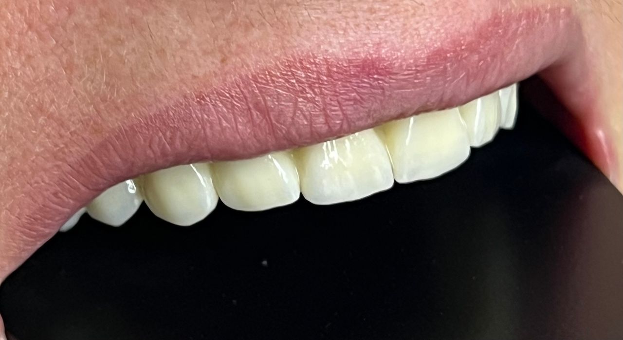 Francesco Giuseppe La Barbera-1