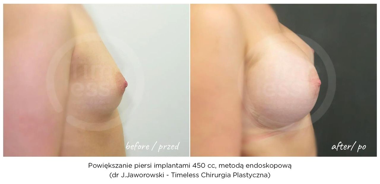 Janusz Jaworowski-102