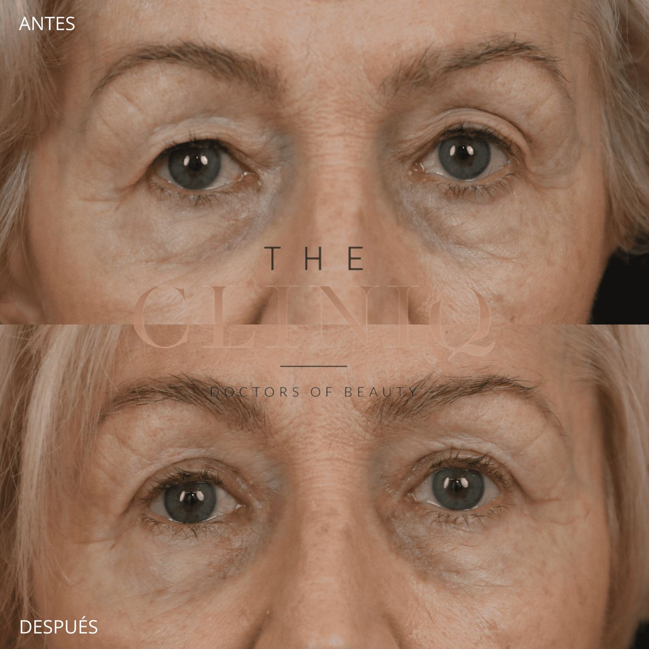 Ignacio Genol Saavedra-14