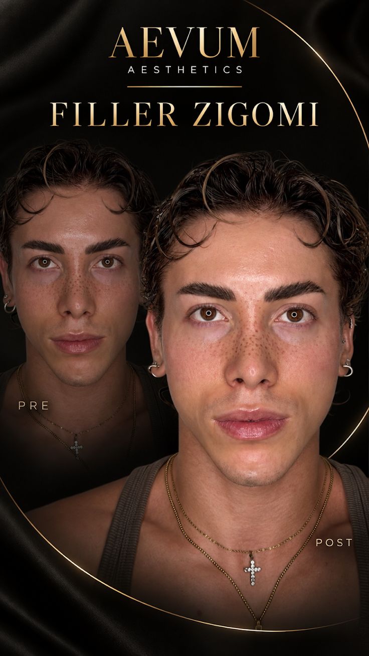 Matteo Terzuoli-2