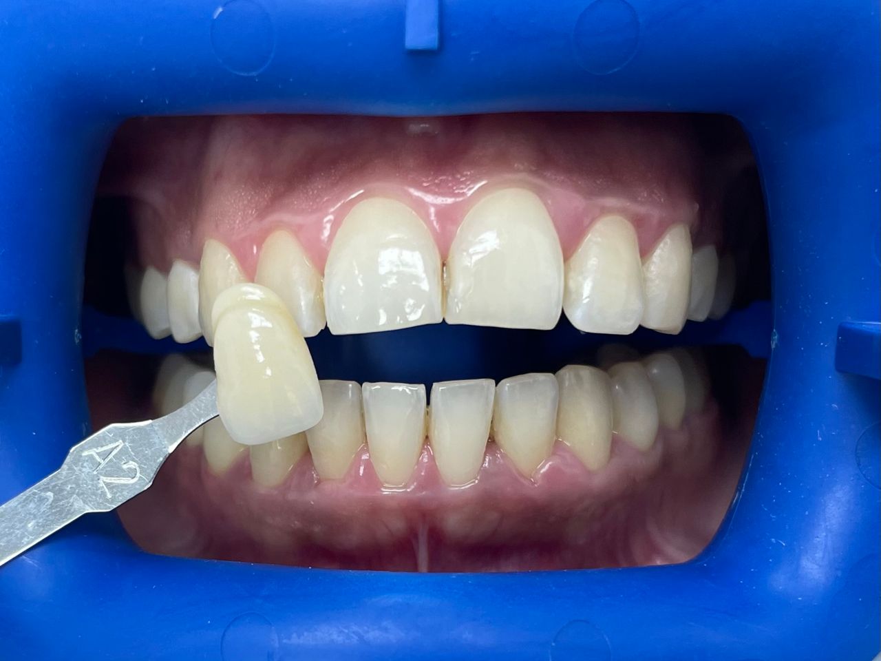 César Buján Riveiro-12