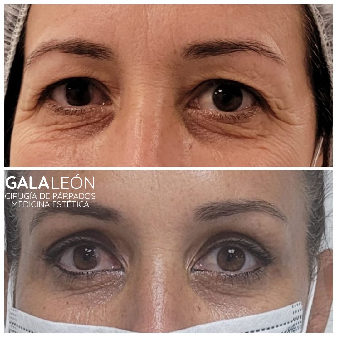 Gala P. Leon Salvatierra-13