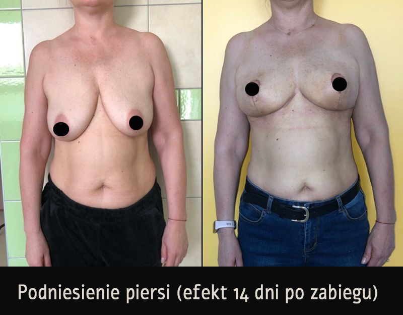 Mariusz Zagajewski-27