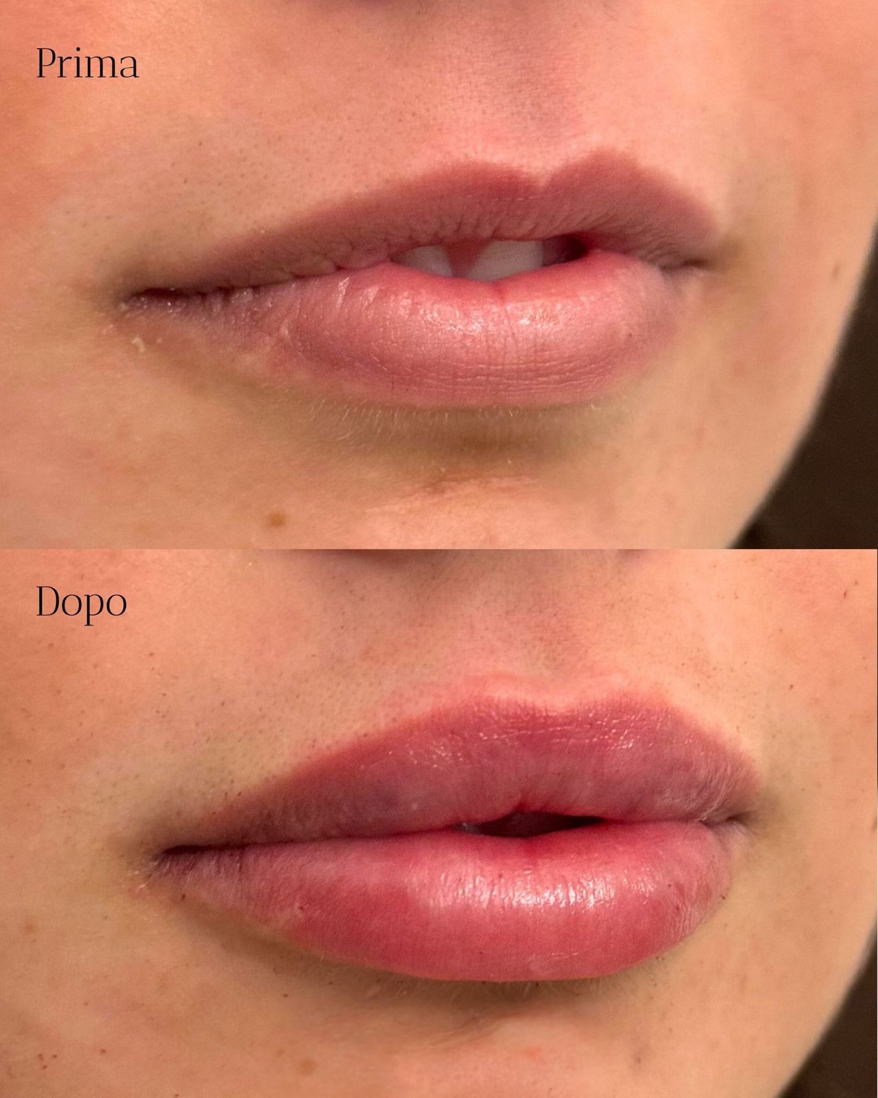 Pier Paolo Ferretti-5