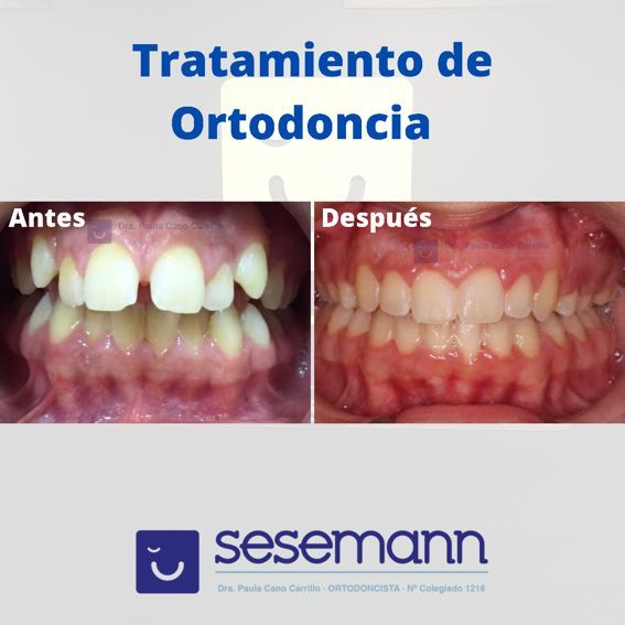 Paula Cano Carrillo-94