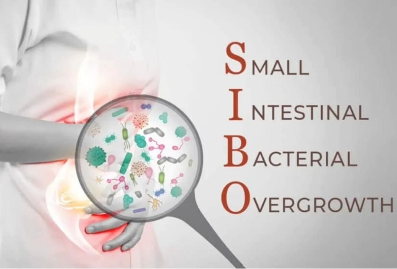 Antonella Vetrella-18