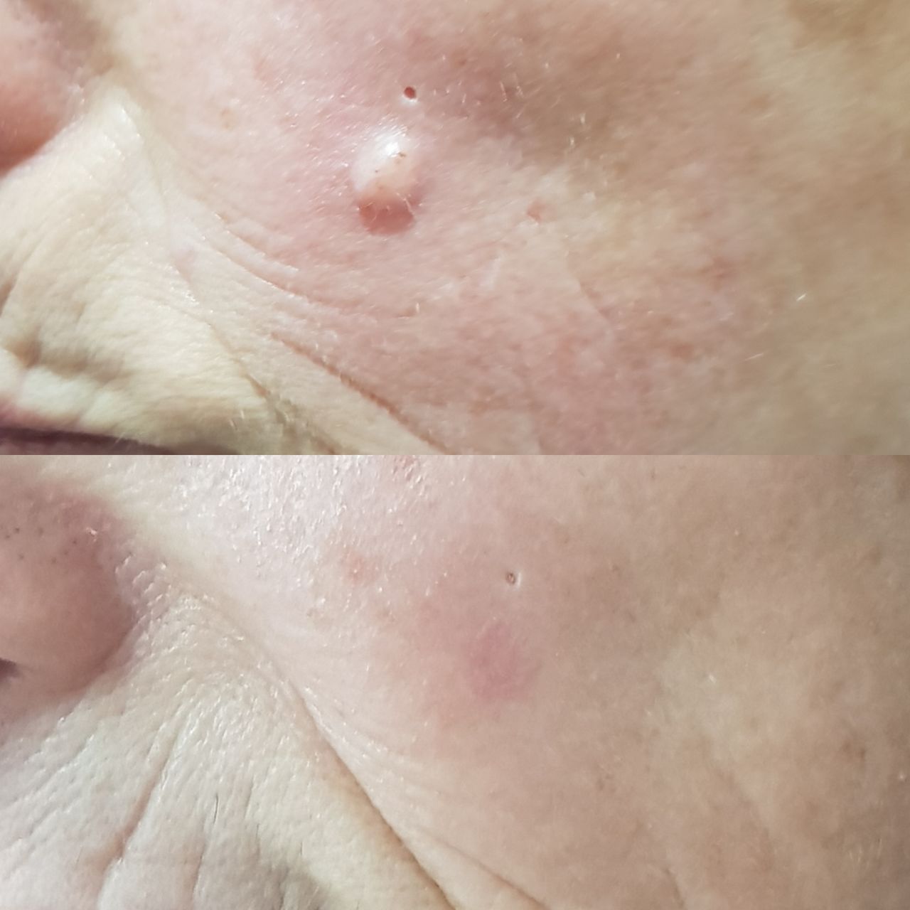 Rosalba Herrero Zerpa-274