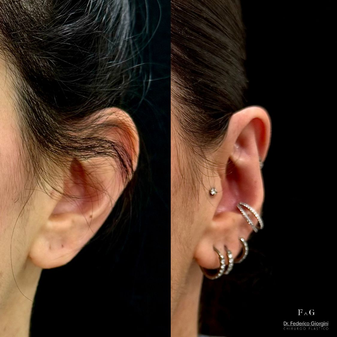 Federico Giorgini-22