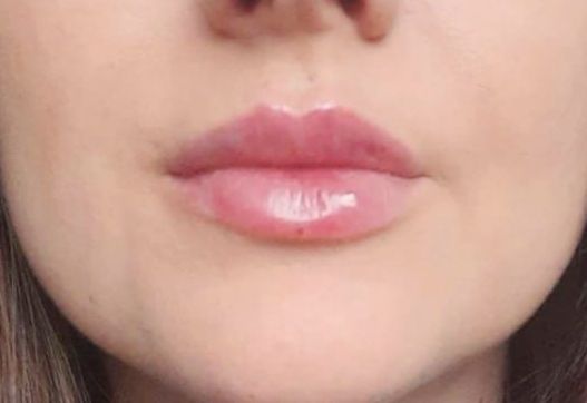 Małgorzata Pożarkowska-Kozik-19