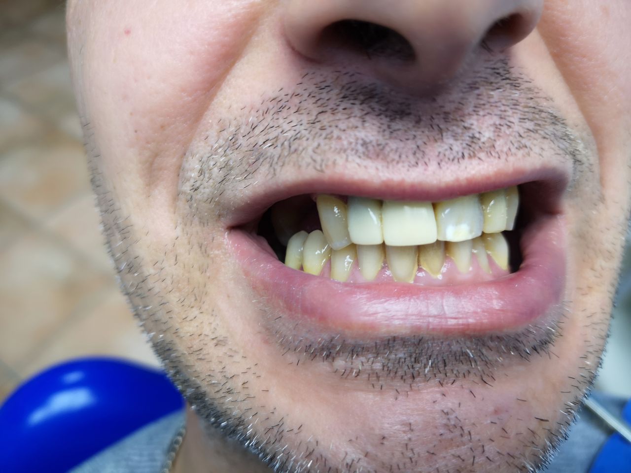 Stefano De Simone-105