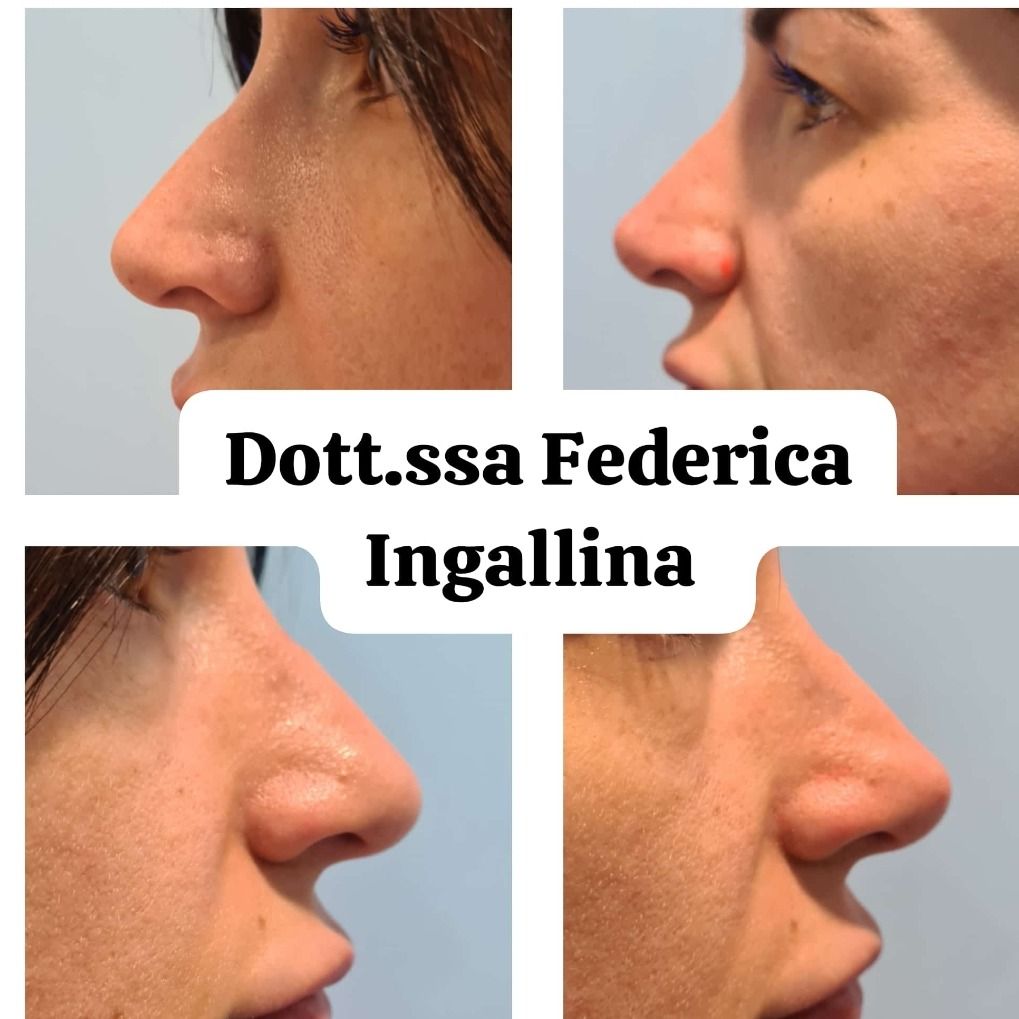 Federica Ingallina-36