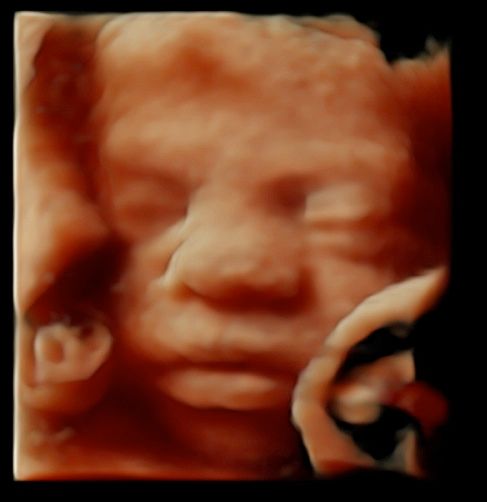 Tommaso Incandela-54