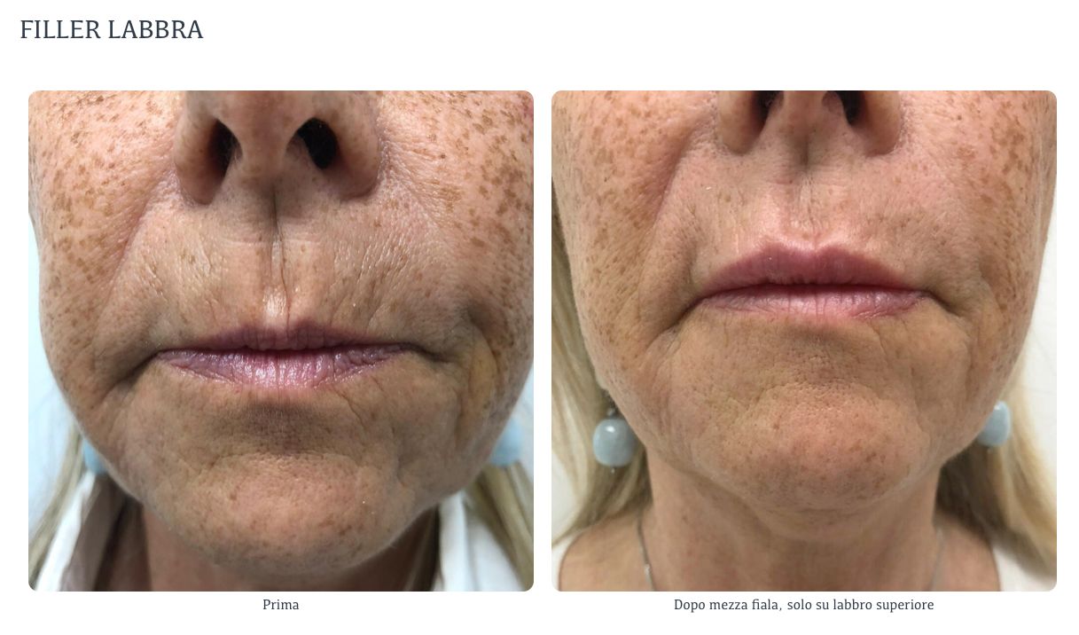 Susanne Innocenti-11