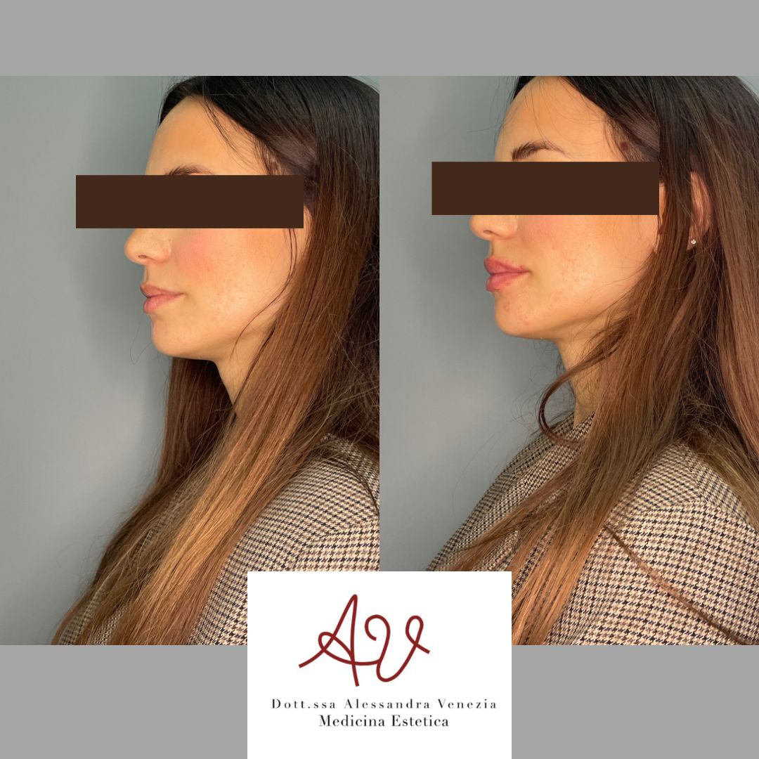 Alessandra Venezia-16