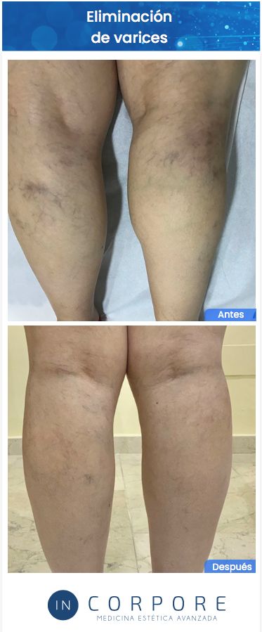 Juan Enrique Pérez Enríquez-142