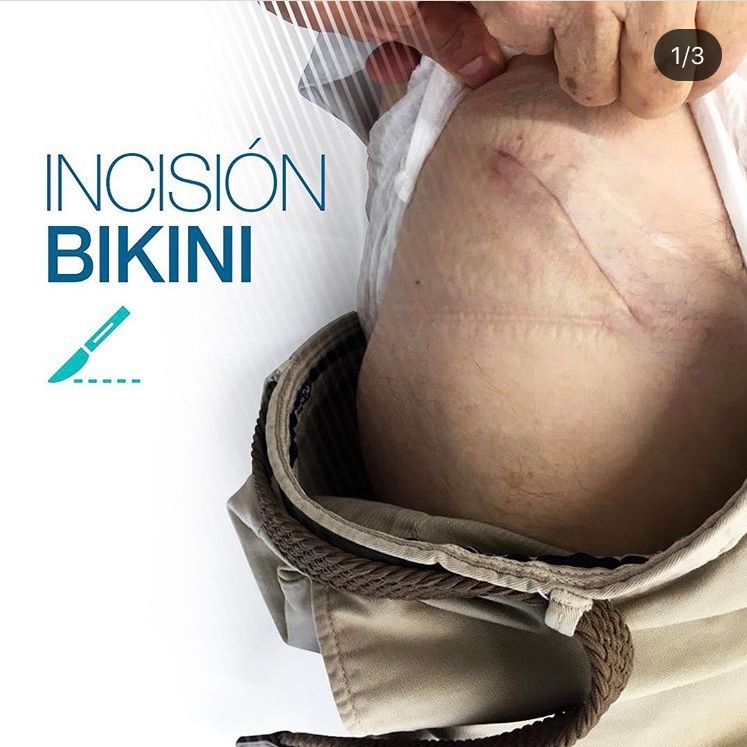 Juan Ramón Prieto Martínez-2