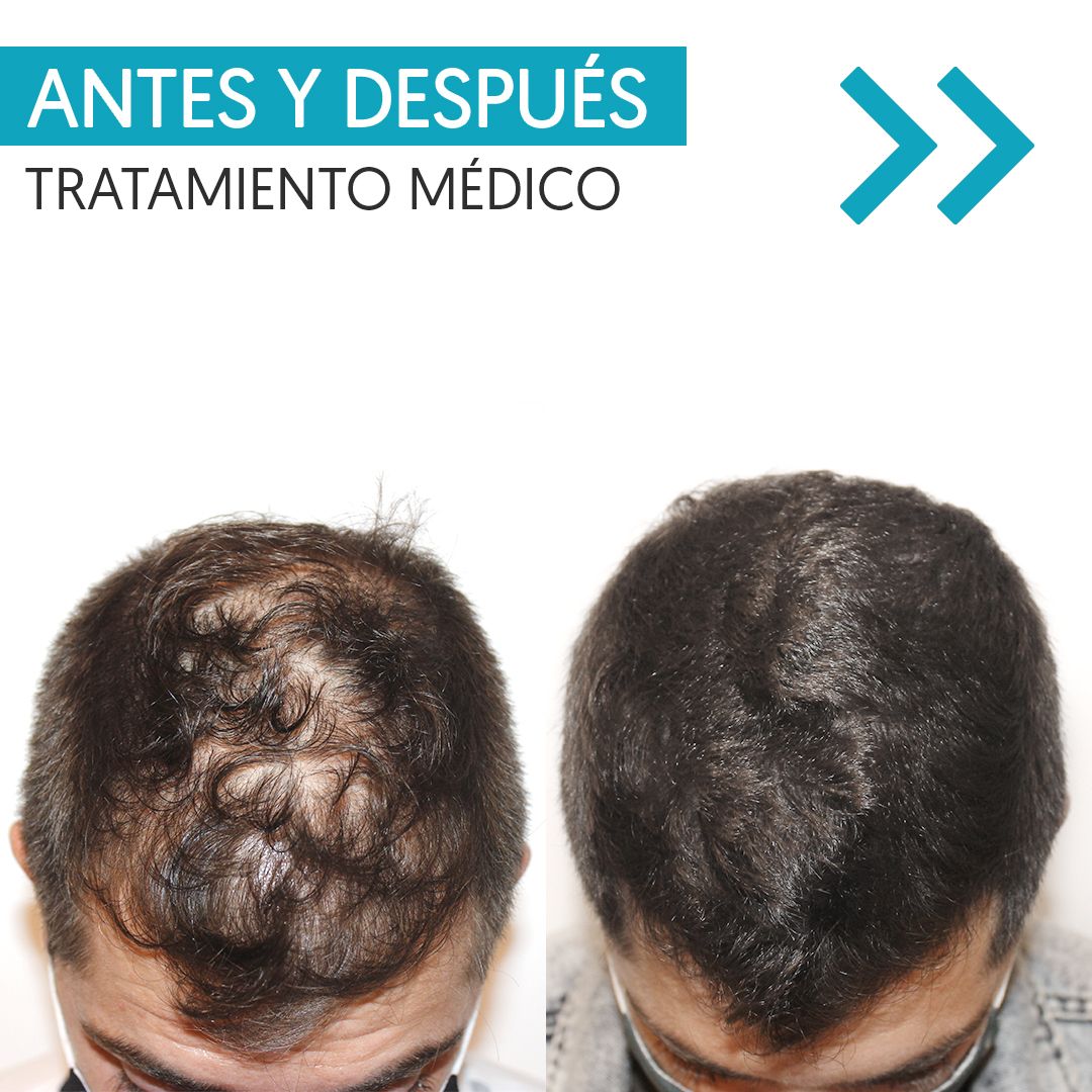 Karlexis León Montilla-17