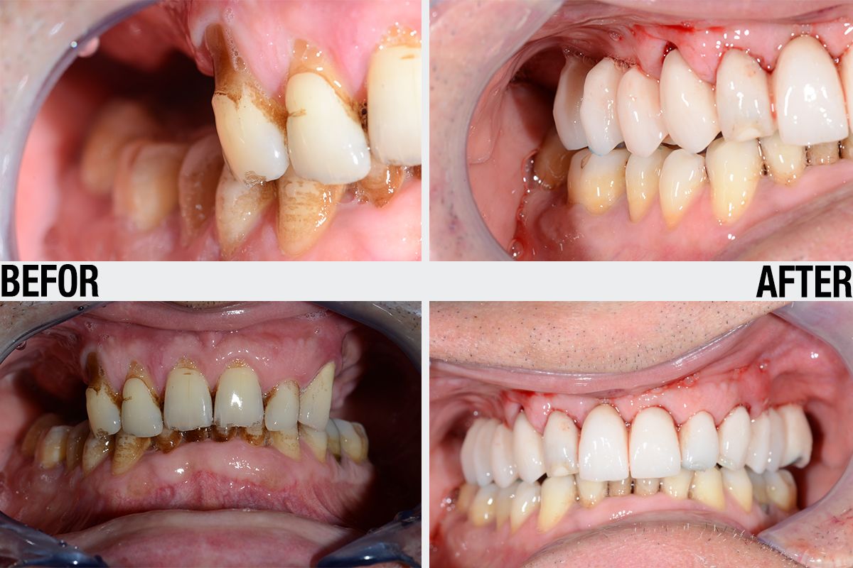 Alessandro Palumbo-34