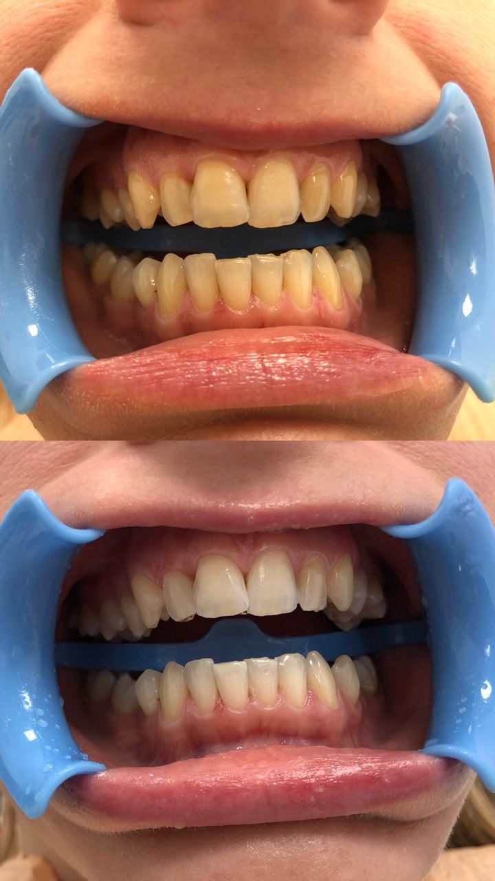 Oleksandra Chernykh-9