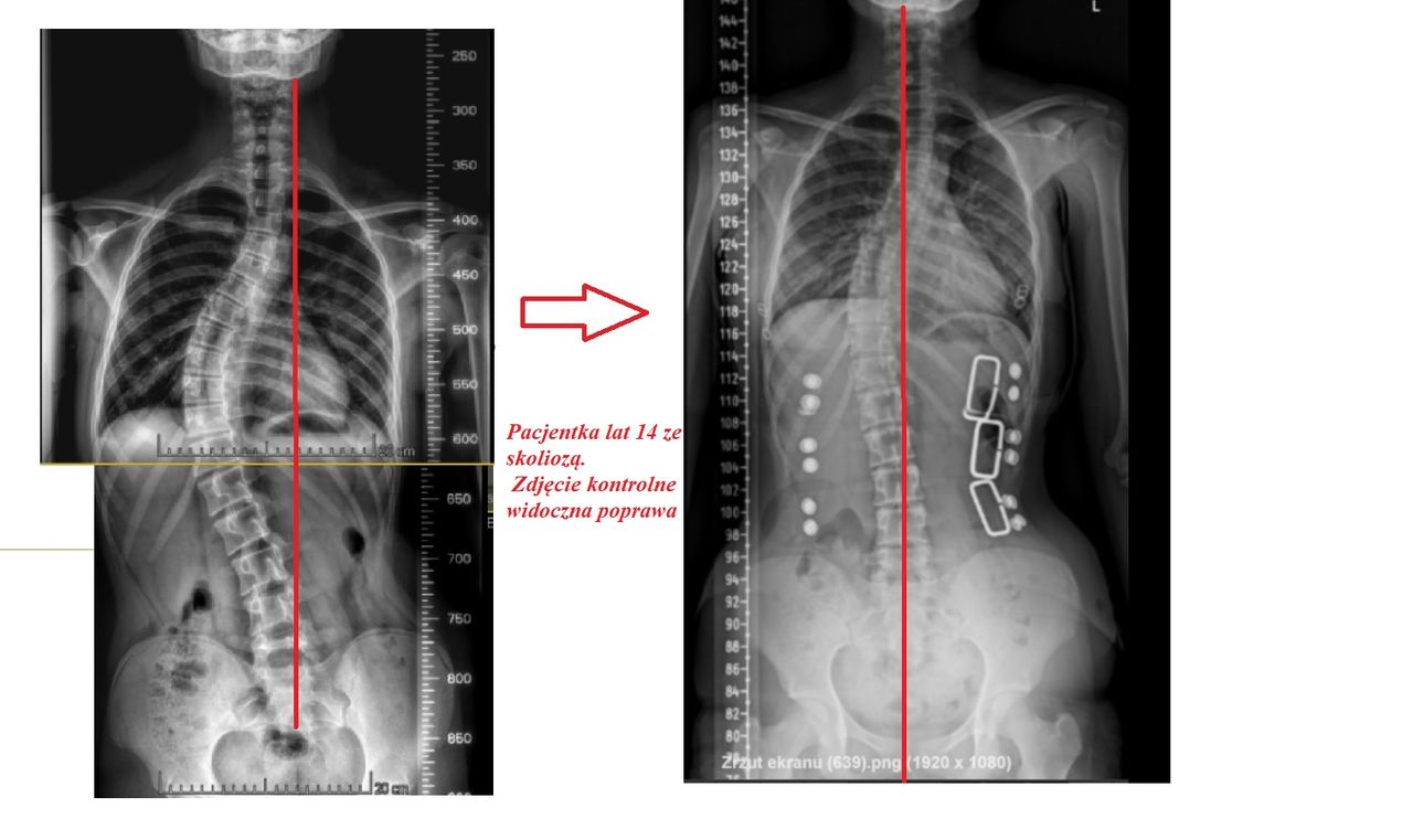 Patrycja Wilczyńska-0