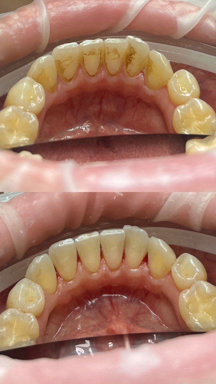 Tetiana Starodubets-7