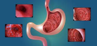 Jose Francisco Juanmartiñena-7