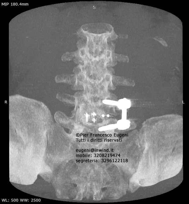 Pier Francesco Eugeni-2