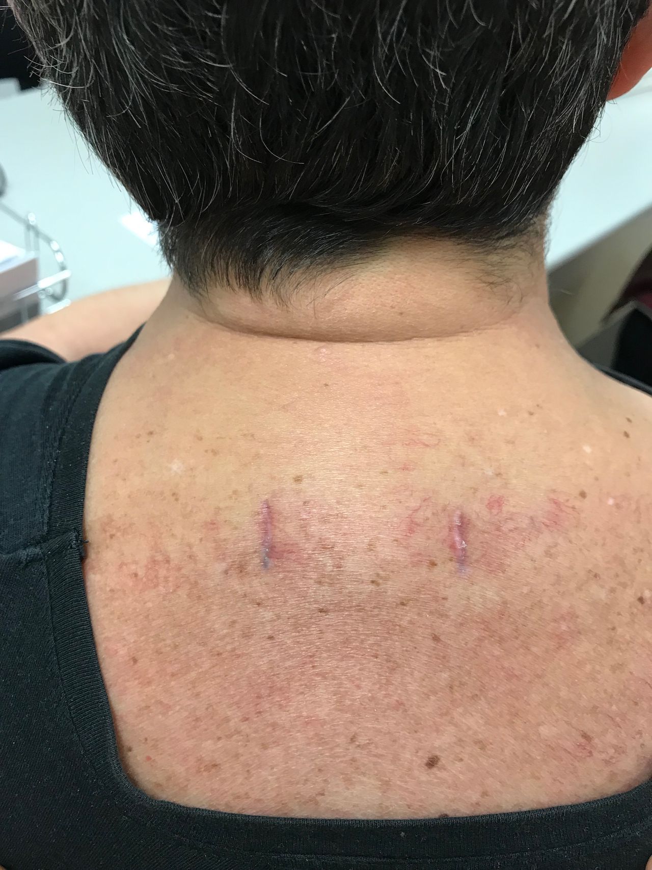 Juan Camilo Hernandez Acevedo-32