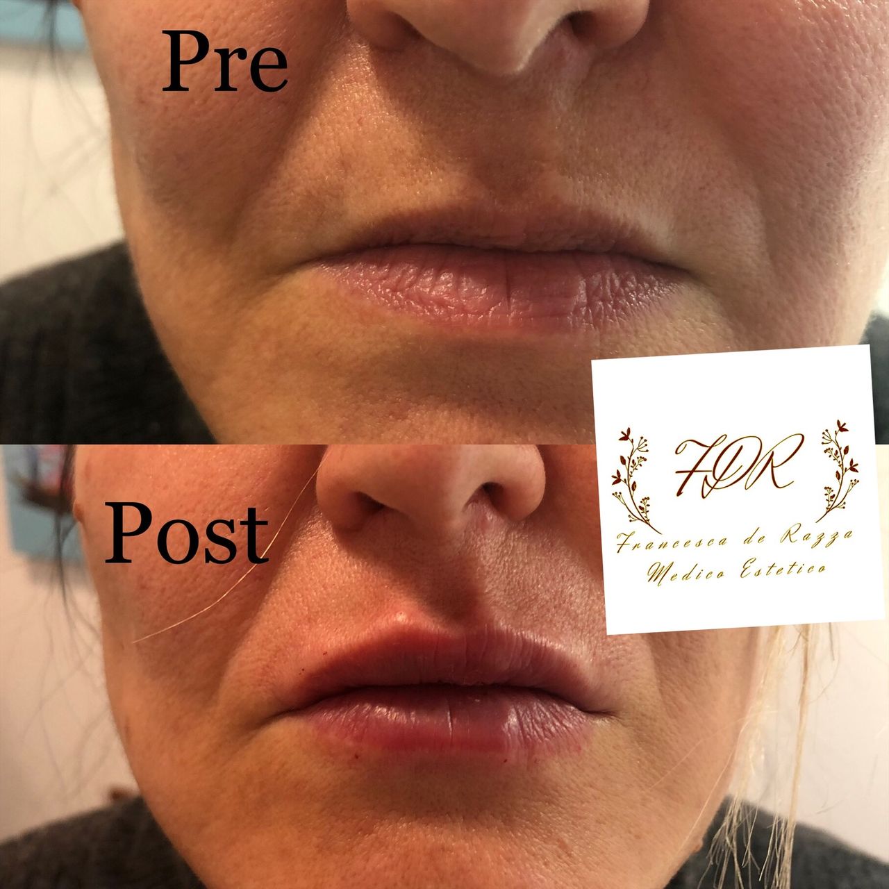 Francesca De Razza-35