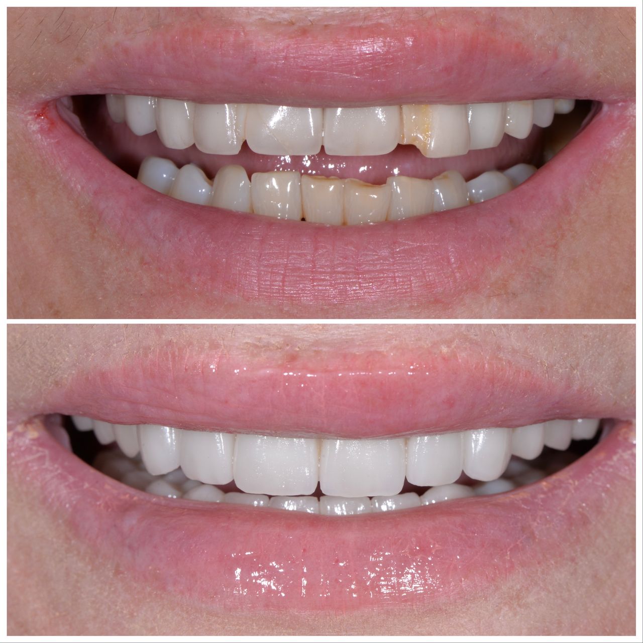 Martin Bartoszcze-44