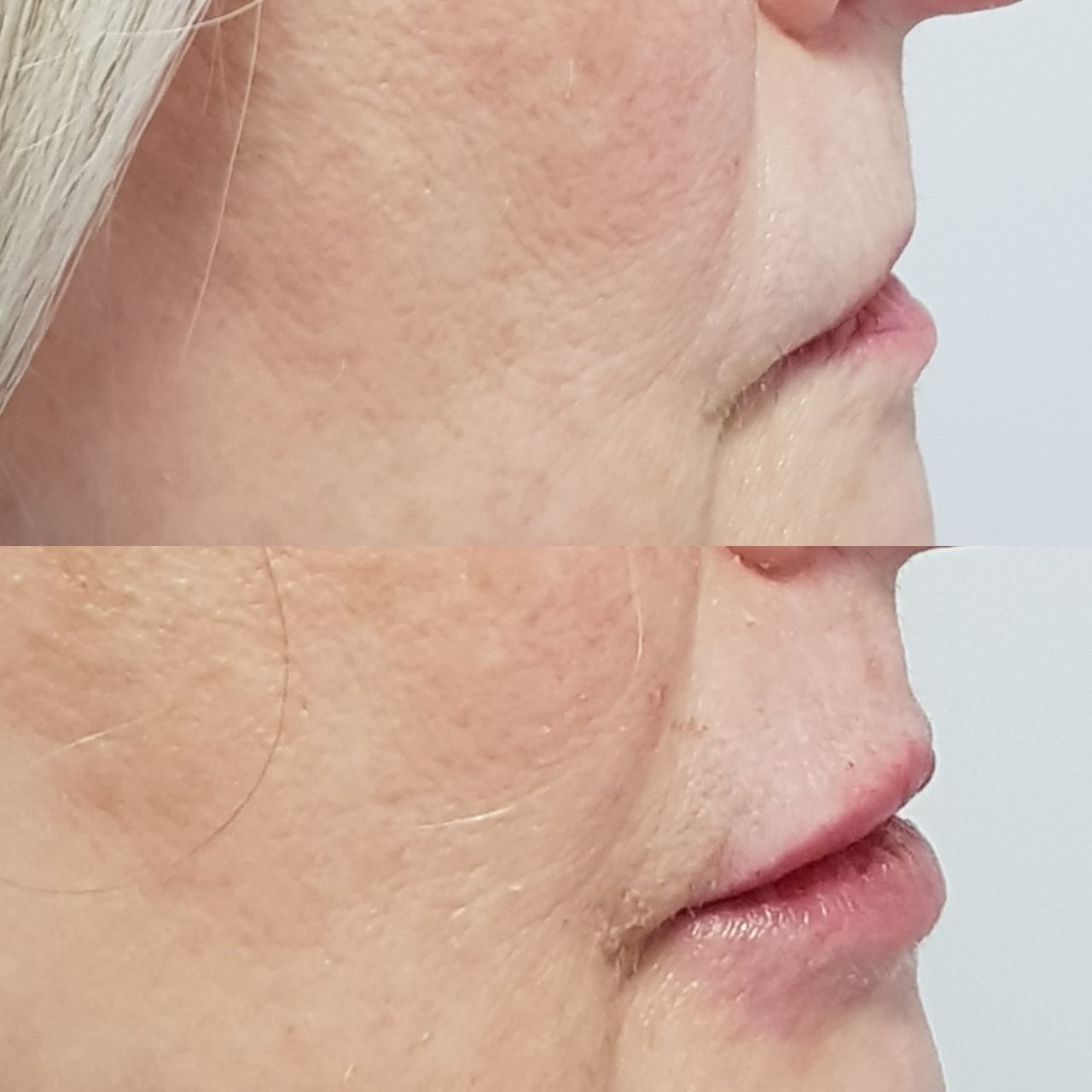 Rosalba Herrero Zerpa-315