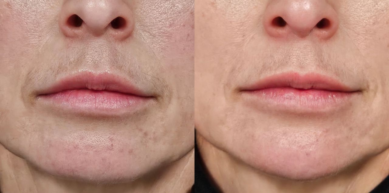 Rosalba Herrero Zerpa-525